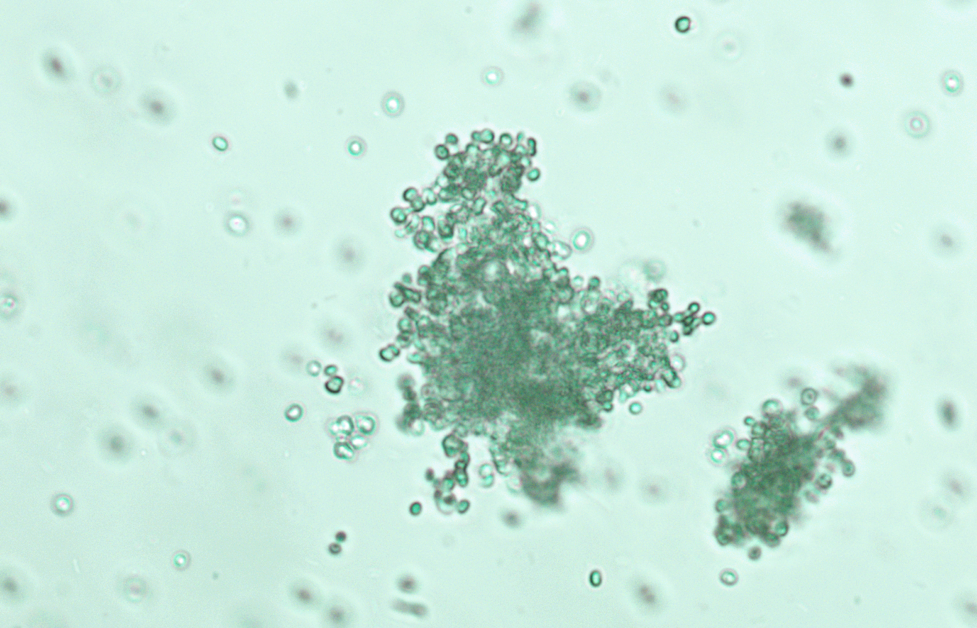 Microcystis, a potentially toxic cyanobacteria that likes to bunch up in clusters, as seen at a 200x magnification.